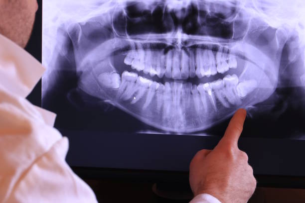 Best Knocked-Out Tooth Emergency  in Valley Falls, KS