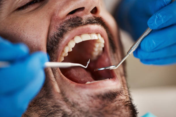 Best Chipped Tooth Repair Near Me  in Valley Falls, KS
