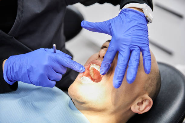 Best Root Canal Emergency Dentist  in Valley Falls, KS